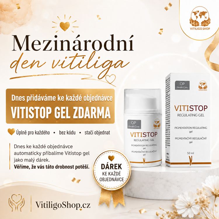 Vitiligo den